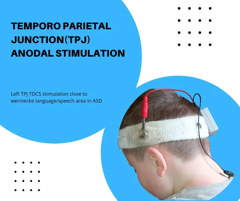 neuromodulation